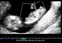 "Embarazadas cero alcohol", nueva web y campaña de Sanidad