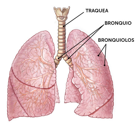 bronquiolitis