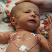 Los bebés prematuros podrán ser monitorizados sin cables, facilitando el piel con piel