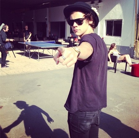 Caca de pájaro contra las espinillas, el remedio más guarro de Harry Styles