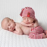 Gemelos con síndrome de Transfusión Feto Fetal en el embarazo: en qué consiste y cómo afecta a los bebés