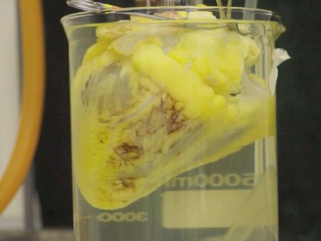 El primer laboratorio del mundo para crear órganos bioartificiales para trasplantes