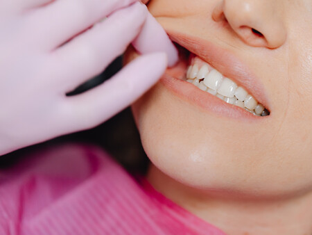 Dientes Blancos