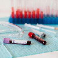Encontrar tests rápidos y fiables para el Alzheimer es una misión clave para la ciencia. Y tenemos un nuevo candidato