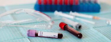 Encontrar tests rápidos y fiables para el Alzheimer es una misión clave para la ciencia. Y tenemos un nuevo candidato