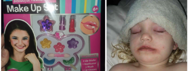 Una niña de tres años sufre una importante reacción alérgica a un maquillaje infantil: claves para prevenir incidentes