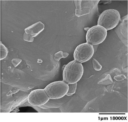 La adaptación de las bacterias frente a variaciones en su entorno