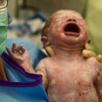 Por qué no se recomienda la maniobra de Kristeller durante el parto