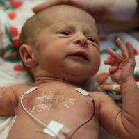 Fallecen dos bebés prematuros en el Hospital Vall d'Hebron por una bacteria que ha contagiado a otros ocho recién nacidos