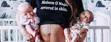 "Ser amable conmigo misma": el inspirador mensaje de una madre de mellizas sobre su cuerpo en el postparto