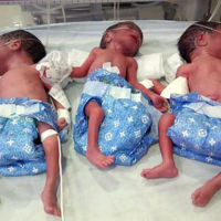 La importancia de hacerte los controles de embarazo: da a luz a cinco niñas pensando que esperaba una 