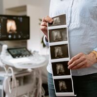 Ecografía 4D en el embarazo: qué es y cuándo es mejor hacerla