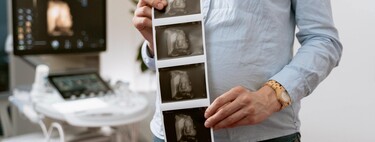 Ecografía 4D en el embarazo: qué es y cuándo es mejor hacerla 