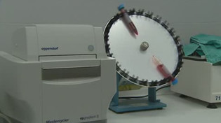 Glibioliquid, el innovador sistema para la detección del cáncer cerebral