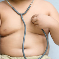 Saltó la alarma: los niños con obesidad a los 8 años muestran ya señales de enfermedad cardíaca