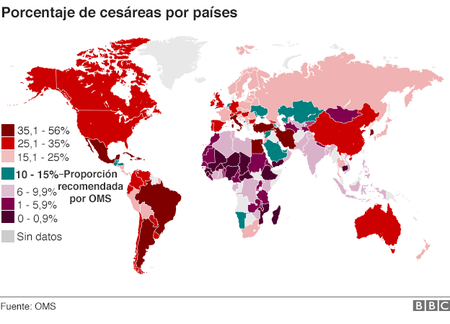indice-de-cesareas-en-el-mundo