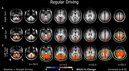 fMRI study 02 Estudio de la actividad cerebral durante la conducción