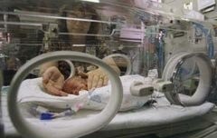 El parto se adelanta por la hipertensión de la madre y por embarazos múltiples