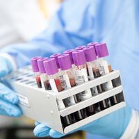 Una simple muestra de sangre tras sufrir un aborto espontáneo podría descubrir la verdadera causa de la pérdida, según científicos daneses 