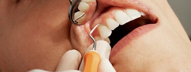 The mouth is more connected to cancer than we thought: they have found a bacteria capable of increasing your risk