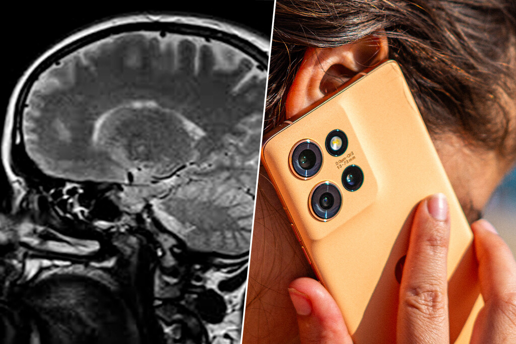 Tu cerebro, 10 años más joven si quitas Internet del móvil. Lo ha demostrado este estudio  