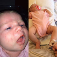 Esta es la razón por la que nadie debería besar en la boca a un bebé: su hija estuvo cerca de no contarlo