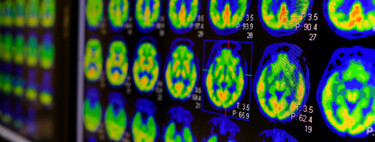 Esqueça as biópsias dolorosas porque a ciência acaba de revelar a tecnologia inesperada que funciona como uma lanterna contra o câncer
