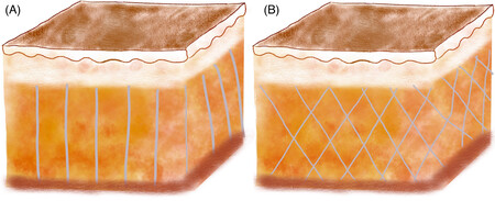 Jocd14815 Fig 0001 M