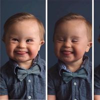 Lo rechazan para una campaña publicitaria por tener Síndrome de Down y su madre inicia una lucha en internet