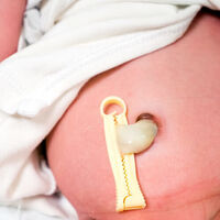 Cuidados del recién nacido: el cordón umbilical