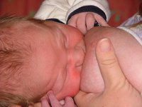 Cómo actuar ante una ingurgitación mamaria