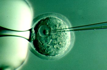 Nacerá un bebé libre de un cáncer de mama hereditario