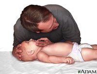 Primeros auxilios: reanimación cardiopulmonar a un bebé (I)