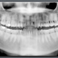 Cazado tras hacerse en el coche el selfie bucal más caro del mundo para enviárselo al dentista