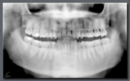 Cazado tras hacerse en el coche el selfie bucal más caro del mundo para enviárselo al dentista