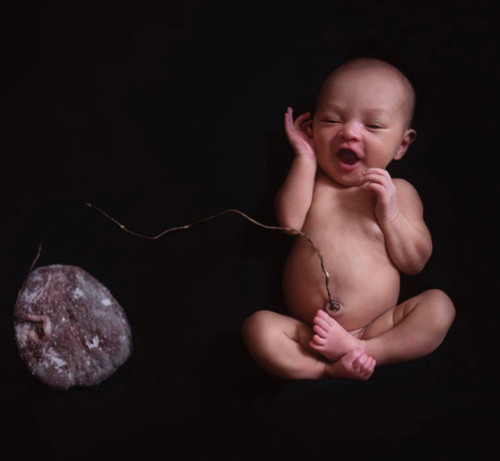 El nacimiento lotus: dejar que la placenta se separe espontáneamente del bebé días después del parto