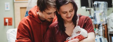 Deciden dar a luz a su hija con anencefalia para donar sus órganos y dar vida a otros bebés 