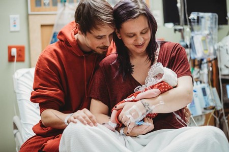 Deciden dar a luz a su hija con anencefalia para donar sus órganos y dar vida a otros bebés