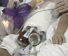 Primera intervención biventricular a un niño en España