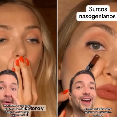 Este experto en antienvejecimiento tiene las claves para evitar los surcos nasogenianos: "ni las cremas ni los rellenos con ácido hialurónico funcionan" 