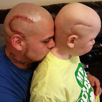 Se hace un tatuaje igual que la cicatriz de su hijo, operado de un cáncer cerebral