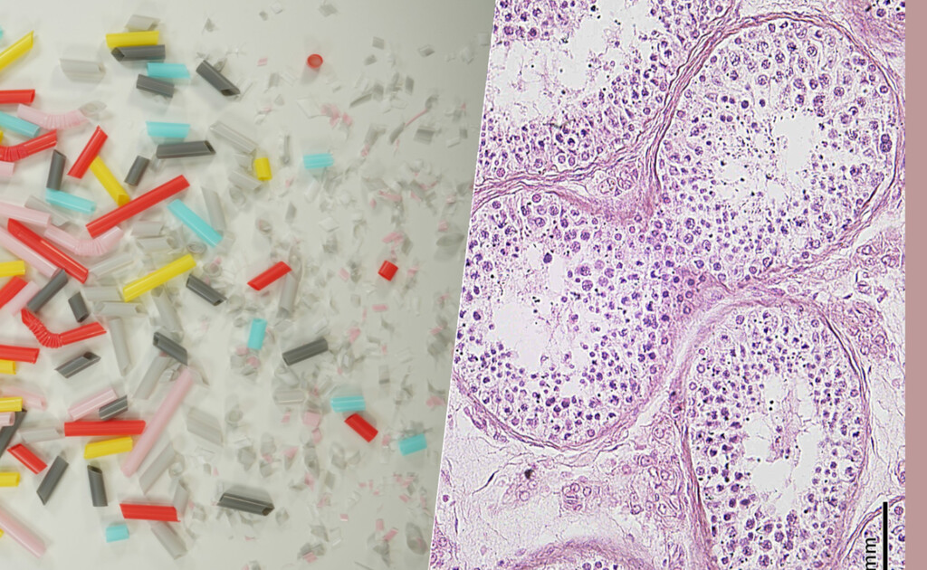 Nuestro problema con los microplásticos es tan descomunal que ya aparecen hasta en los testículos humanos
