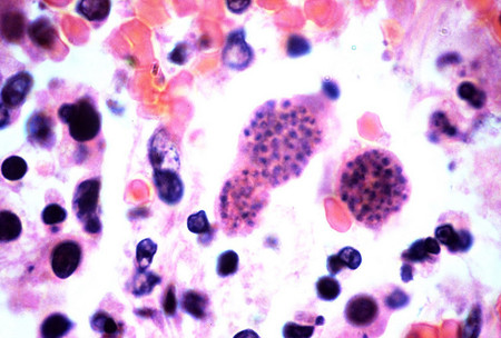 Toxoplasmosis, un dolor de cabeza para toda embarazada