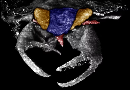 Ct Scanning Insekt