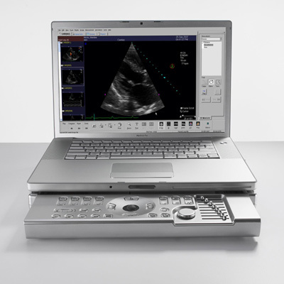 Macbook Pro de Siemens: Si eres cardiólogo, te va a encantar