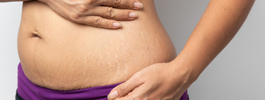 Por qué es importante amar tu cuerpo postparto tanto como amabas tu barriga de embarazada