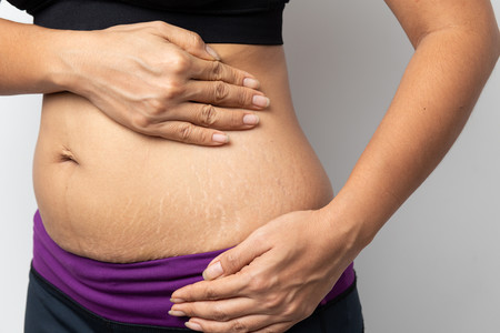 Por qué es importante amar tu cuerpo postparto tanto como amabas tu barriga de embarazada