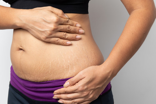 Por qué es importante amar tu cuerpo postparto tanto como amabas tu barriga de embarazada
