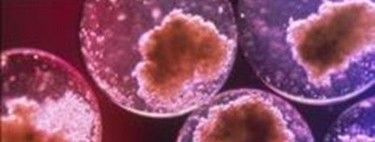 Lo que hay que saber antes de decidir conservar las células madre del cordón