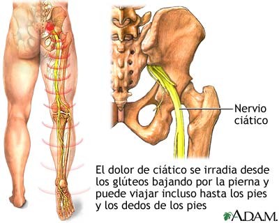 Me duele la espalda baja y estoy embarazada
